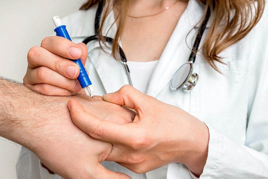 Doctor removing a tick with tweezers